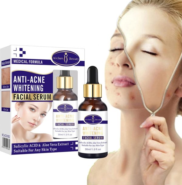Aichun Beauty Anti-Acne Whitening Serum – Aloe Vera & Salicylic Acid (30ml)