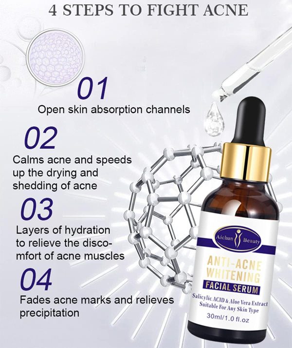 Aichun Beauty Anti-Acne Whitening Serum – Aloe Vera & Salicylic Acid (30ml)