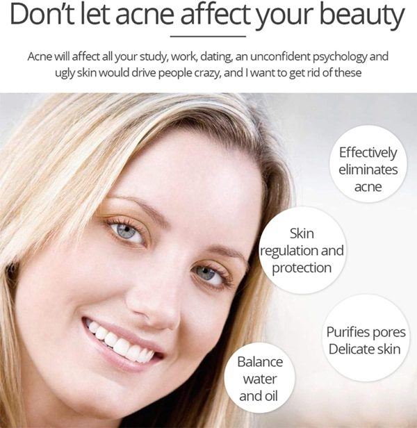 Aichun Beauty Anti-Acne Whitening Serum – Aloe Vera & Salicylic Acid (30ml)
