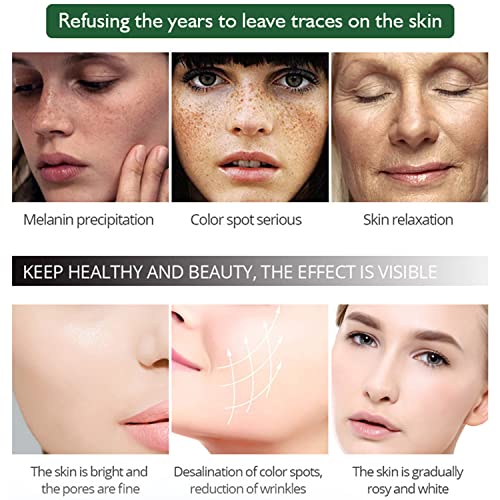 Aichun Beauty Anti-Freckle Facial Serum – Nicotinamide & Green Tea Extract (30ml)
