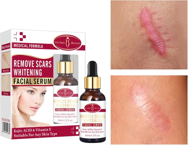Aichun Beauty Scar Removal Serum – Kojic Acid & Vitamin E for Scars & Stretch Marks (30ml)