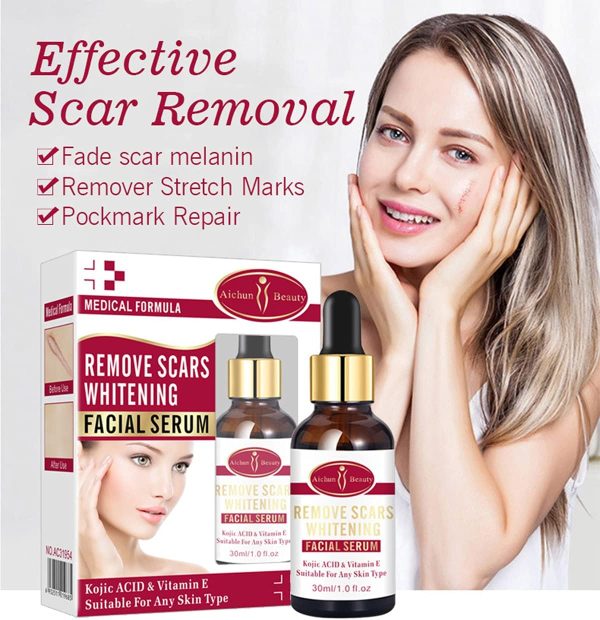 Aichun Beauty Scar Removal Serum – Kojic Acid & Vitamin E for Scars & Stretch Marks (30ml)