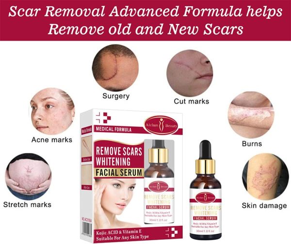 Aichun Beauty Scar Removal Serum – Kojic Acid & Vitamin E for Scars & Stretch Marks (30ml)