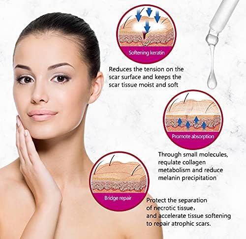Aichun Beauty Scar Removal Serum – Kojic Acid & Vitamin E for Scars & Stretch Marks (30ml)