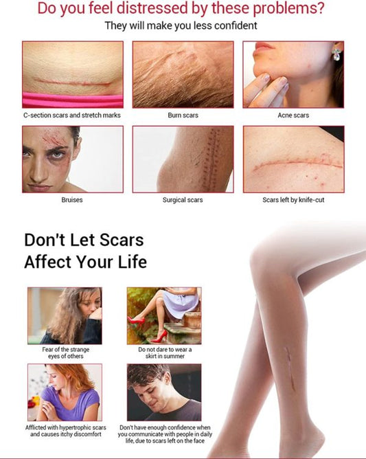 Aichun Beauty Scar Removal Serum – Kojic Acid & Vitamin E for Scars & Stretch Marks (30ml)